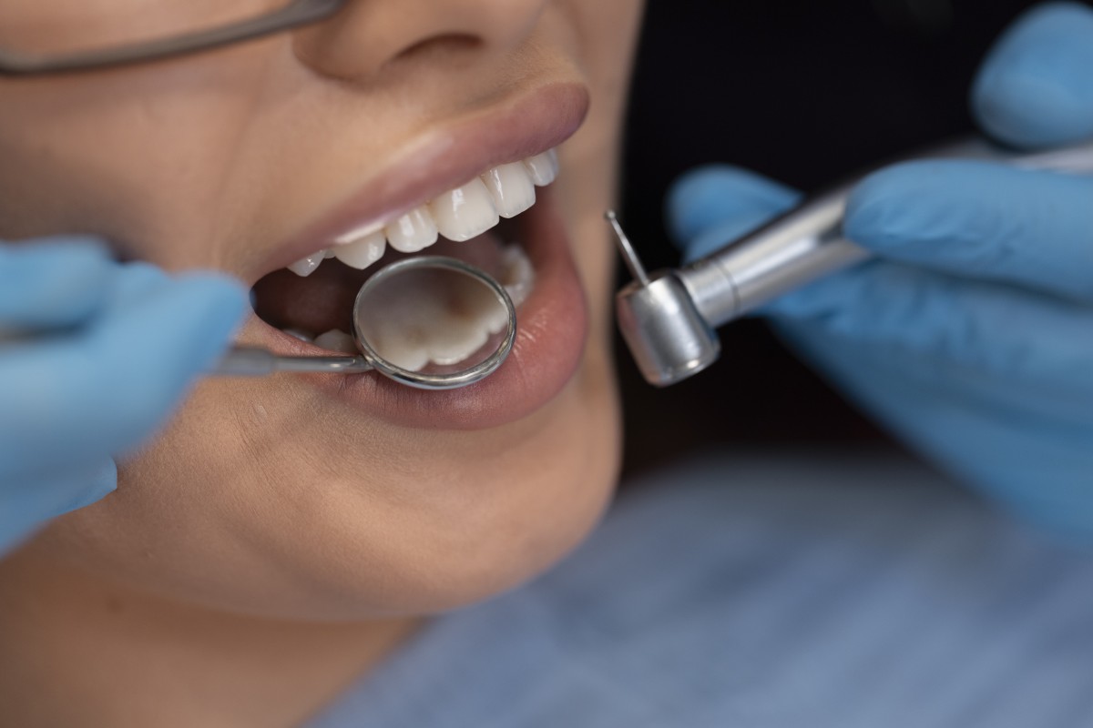 close-up-dentist-using-instruments